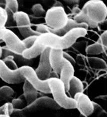 Gênero Campylobacter Primeiras descrições feitas por Escherich em