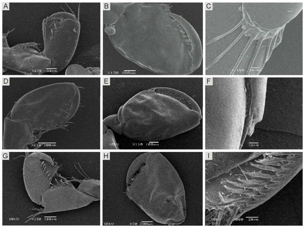 Fig. 23. Fotos de Microscopia Eletrônica de Varredura. Hyalella sp. nov. 1, parátipo macho: (A) gnatópodo 1; (B) gnatópodo 2; (C) carpo do gnatópodo 2. Hyalella sp. nov. 2, parátipo macho: (D) gnatópodo 1; (E) gnatópodo 2; (F) carpo do gnatópodo 2.