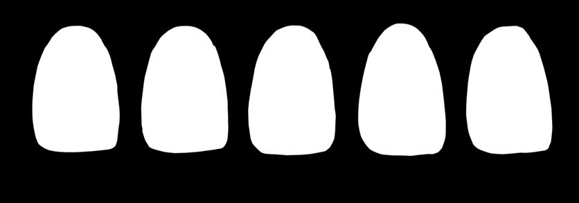 Isso está diretamente ligado à percepção de cor/valor das restaurações de resina, pois uma grande quantidade de opaco (dentina) resulta em maior reflexão de luz e um aspecto leitoso da restauração;