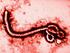 A doença por Ébola, de que se trata?