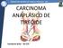 CARCINOMA ANAPLÁSICO DE TIREÓIDE. Humberto Brito R3 CCP