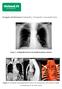 Imagem da Semana: Radiografia, Tomografia computadorizada