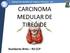 CARCINOMA MEDULAR DE TIREÓIDE. Humberto Brito R3 CCP