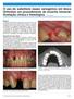 O uso do substituto ósseo xenogênico em bloco OrthoGen em procedimento de enxertia intraoral. Avaliação clínica e histológica.