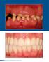 Clínica - International Journal of Brazilian Dentistry, Florianópolis, v.9, n.2, p. 72-77, abr./jun. 2013
