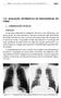 [251] 114. AVALIAÇÃO SISTEMÁTICA DE RADIOGRAFIAS DO TÓRAX