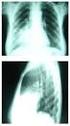 Diretrizes brasileiras para tratamento das pneumonias adquiridas no hospital e das associadas à ventilação mecânica - 2007