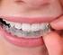 Principais problemas odontológicos dos adolescentes
