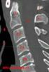 Imagiologia da Coluna Vertebral: Tomografia Computadorizada da Coluna. Coluna vertebral; Tomografia Computadorizada