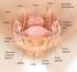 Hysterectomy. Fallopian Tube. Uterus. Ovary. Cervix. Vagina. Labia