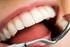Interrelação Periodontia e Dentística Restauradora na lapidação de facetas cerâmicas