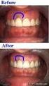 Periodontal Surgeries Applied To Operative Dentristy