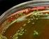 Estudo da prevalência de resistências a antibióticos de. bactérias associadas a infeções urinárias no Algarve