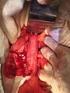 Tratamento cirúrgico dos aneurismas da aorta abdominal em octogenários: resultados a longo prazo