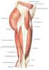 Músculos da Perna. Músculos da Perna. Músculos. Membros Inferiores. Músculos da Perna. Regiões. Perna e Pé. Tibial Anterior. Divisão.