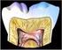 Avaliação da indicação de materiais para proteção do complexo. Evaluation of indication for dental materials to protect the dentin pulp