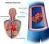 Distúrbios hemodinâmicos