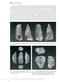 FIG Fariseu, unidade estratigráfica 4, núcleo de quartzo utilizado