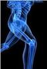 Densidade mineral óssea em crianças. Associação com dor músculo-esquelética e/ou hipermobilidade articular