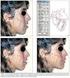 AVALIAÇÃO DE MEDIDAS CEFALOMÉTRICAS EM IMAGENS OBTIDAS A PARTIR DA TELERRADIOGRAFIA DE PERFIL E DA TOMOGRAFIA COMPUTADORIZADA CONE BEAM