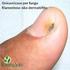 Onicomicoses causadas por fungos filamentosos não dermatófitos