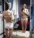 Distúrbio Alimentar; Bulimia e Anorexia.