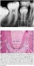 Dentes com Rizogênese Incompleta e Movimento Ortodôntico: Bases Biológicas