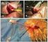 Sistema de enxerto de stent abdominal Instruções de utilização