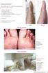 Limitação funcional relacionada ao pé doloroso em idosos