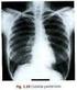 Radiografia simples do tórax: noções de anatomia
