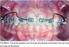 Emprego racional da Biomecânica em Ortodontia: arcos inteligentes