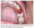 ANÁLISE CLÍNICA DE LESÕES VASCULARES BUCAIS TRATADAS CIRURGICAMENTE CLINICAL ANALYSIS OF ORAL VASCULAR LESIONS TREATED SURGICALLY