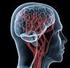 Estudo epidemiológico sobre acidente vascular encefálico em uma clínica escola de Fisioterapia