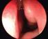 Efeito do controle ambiental e corticosteróide nasal em pacientes com rinite alérgica persistente