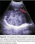 Ultra-sonografia nas Lesões Hepáticas Focais Benignas. Dr. Daniel Bekhor DDI - Radiologia do Abdome - UNIFESP