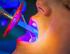 Laserterapia como técnica auxiliar no tratamento periodontal