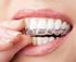 Resumo O ortodontista tem um papel importante na vida de seus pacientes portadores de deformidades. Abstract
