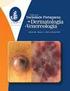 Melanoma maligno cutâneo: sistema de pontos (scoring system) para auxílio no diagnóstico histopatológico