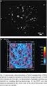 Síntese e atividade microbiana de nanopartículas metálicas