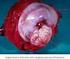 Management of adenocarcinoma in situ of the cervix Adenocarcinoma in situ do colo do útero: experiência de um centro de referência
