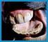 Dentição e Métodos de Identificação em