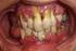 Doenças periodontais como doenças infecciosas