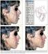 Estudo dos Determinantes Cefalométricos da Relação Ântero- Posterior Maxilomandibular em Amostra de Oclusão Normal