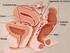 Resumo A endometriose é uma doença crônica de mulheres em idade reprodutiva