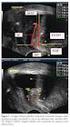 Topografia da junção uretrovesical e da uretra proximal no puerpério tardio de primíparas continentes após parto transpelviano e cesária intra-parto