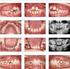 PREVALÊNCIAS DAS ANOMALIAS DENTÁRIAS OBSERVADAS EM CRIANÇAS DE 5 A 12 ANOS DE IDADE NO MUNICÍPIO DE BELÉM - UM ESTUDO RADIOGRÁFICO