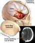 Contusão Cerebral 1. Definição. Trauma. Achados de imagem. Aspectos clínicos