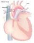 Malformações Congénitas Pulmonares. Experiência de Quatro Anos (93-96)