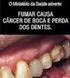 Lesões pré-cancerizáveis da boca: Revista de Literatura. Fernando Vacilotto Gomes 1