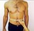 Circunferência da cintura e relação cintura/estatura: úteis para identificar risco metabólico em adolescentes do sexo feminino?